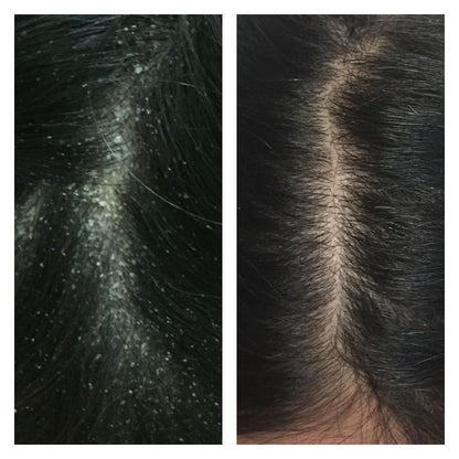 Poudre de Souffre purifiée